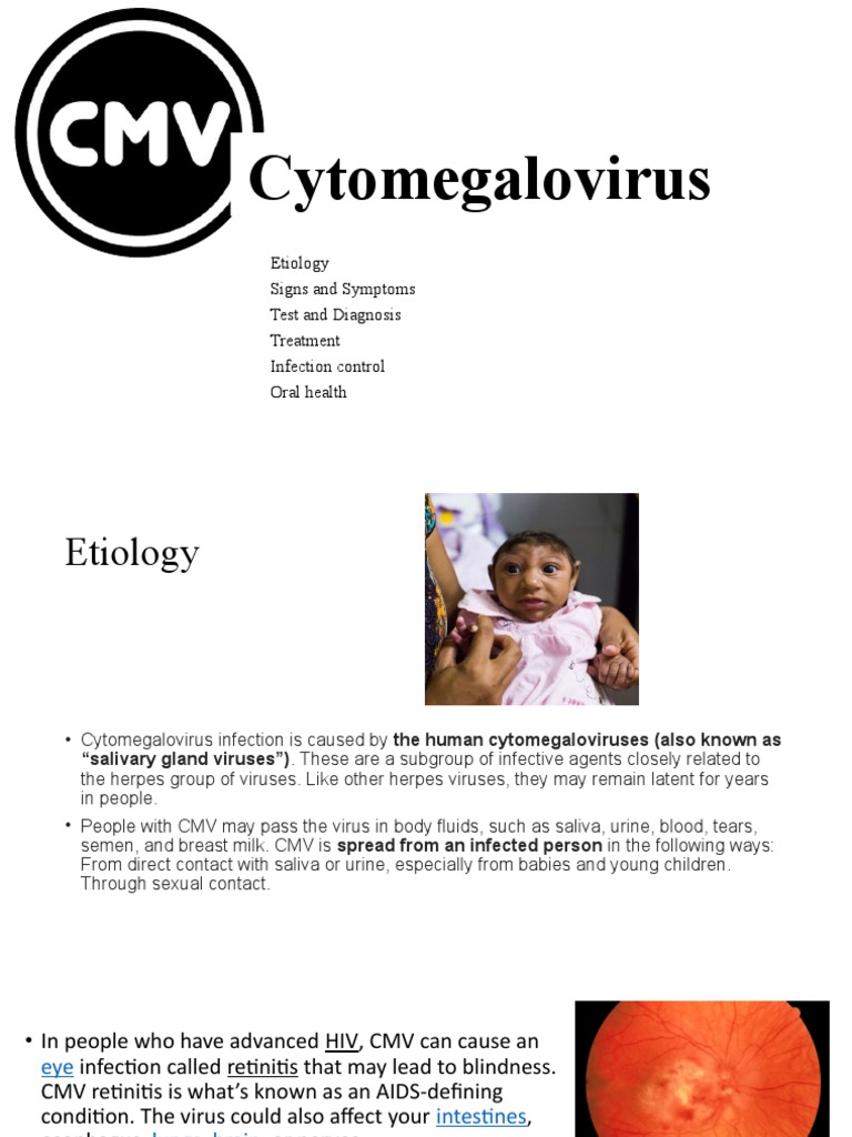 Cytomegalovirus: Symptoms, Treatments, And Types – NAPJLY