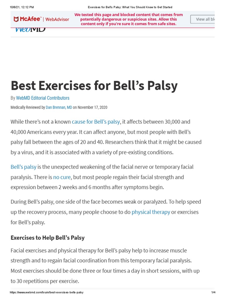 PHYSIOTHERAPY TREATMENT FOR BELL'S PALSY