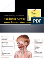 Paediatric Airway - Top Tips