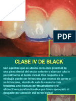 Operatoria Dental 9 ppt
