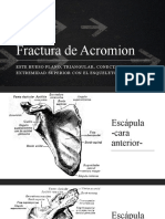 Fractura de Acromion