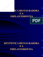 Dentística X Implantodontia