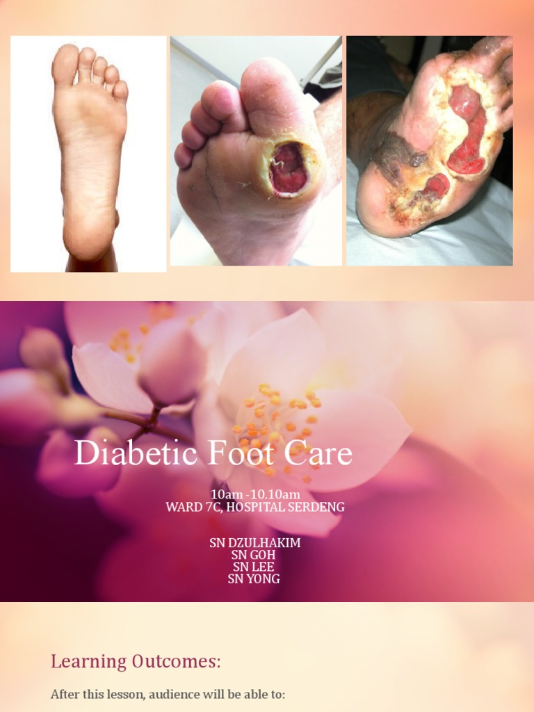 Diabetic Foot Care PDF
