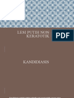 Lesi Putih Non Keratotik