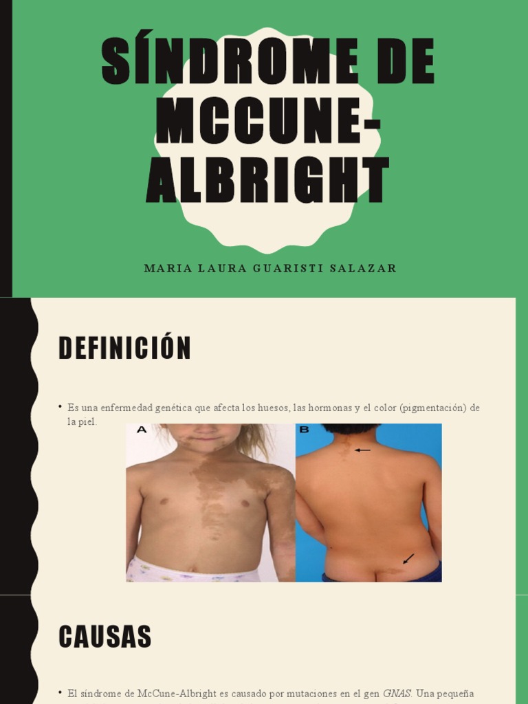 Síndrome de McCune-Albright | PDF