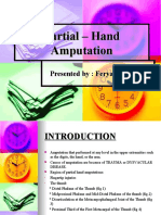 Partial - Hand Amputation