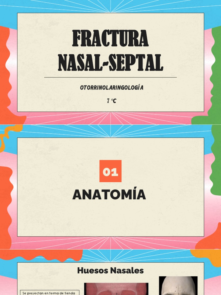 Fracturas nasales: clasificación, diagnóstico y tratamiento | PDF ...