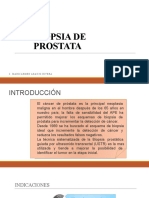 Biopsia de Prostata