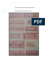 Taller Electrocardiografía Básica