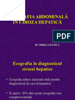 Ecografia Abdominal A in Ciroza Hepatica