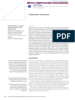 Cutaneous Sarcomas