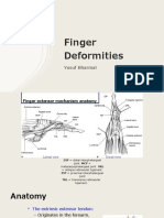 Finger Deformities