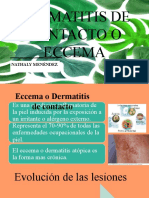 Dermatitis de Contacto o Eccema