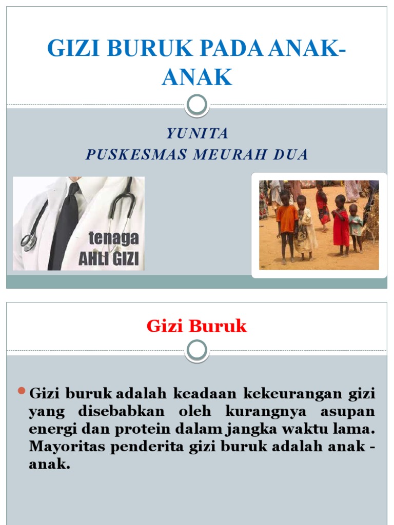 Gizi Buruk Pada Anak | PDF