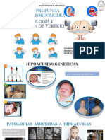 Hipoacusia y Vertigo