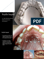 Rejilla Lingual (2)