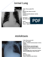 Catatan Radiologi