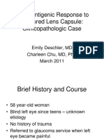 Phacoantigenic Response To Ruptured Lens Capsule: Clinicopathologic Case
