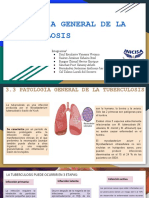 Patología General de La Tuberculosis