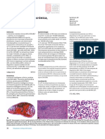 Leucemia Mieloide Crónico