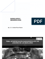 USMP Interpretacion Radiografica, Quistes de Los Maxilares (Modo de Compatibilidad)