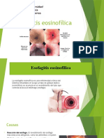 Esofagitis Eosinofílica