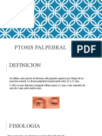 Ptosis Palpebral