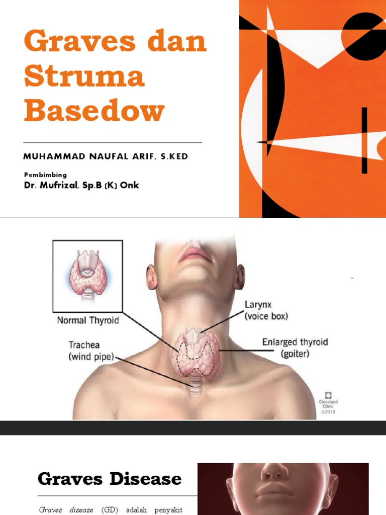 Penyakit Graves dan Struma Basedow | PDF