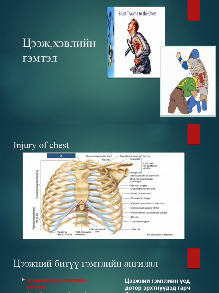 Цээж гэмтэл | PDF