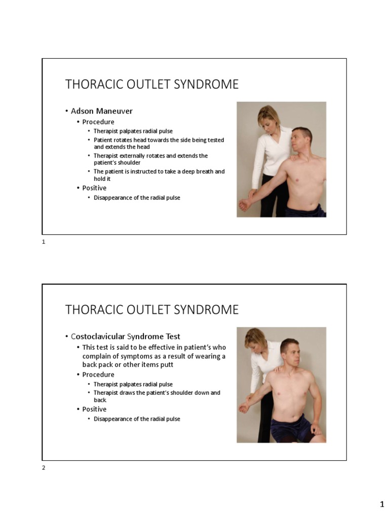 Thoracic Outlet Syndrome: - Adson Maneuver | PDF | Anatomical Terms Of ...