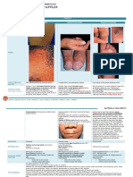 (DERMA) 06 Asymptomatic Skin Colored Papules
