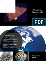 Carcinoma Hepatico y Li-Desktop-pip6dg6