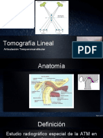 ATM Lineal