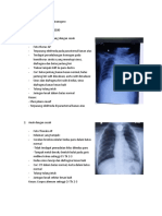 Dolly Milan Wiranegoro - XC064191020 - Tugas Radiologi