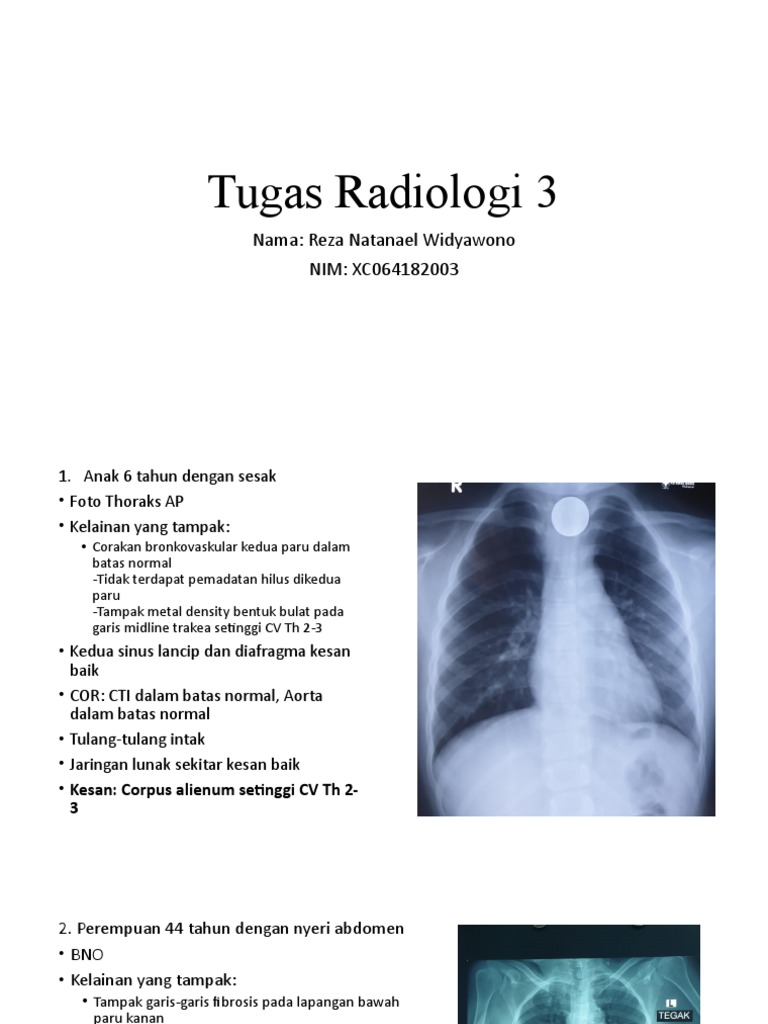 Tugas Radiologi: Temuan Klinis dan Kesan | PDF | Sains & Matematika