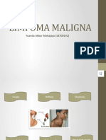 Limfoma Maligna - Yuanda Akbar Mahajaya - 18700142