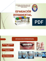 Separacion Interdental