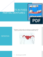 Abutments in Fixed Partial Dentures