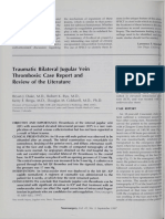 Traumatic Bilateral Jugular Vein Thrombosis Case Report and Review of The Literature