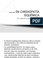3 - Ecg en Cardiopatía Isquémica
