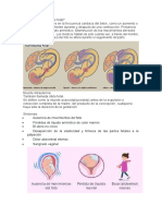 Cómo Funciona El Cardiotocografo