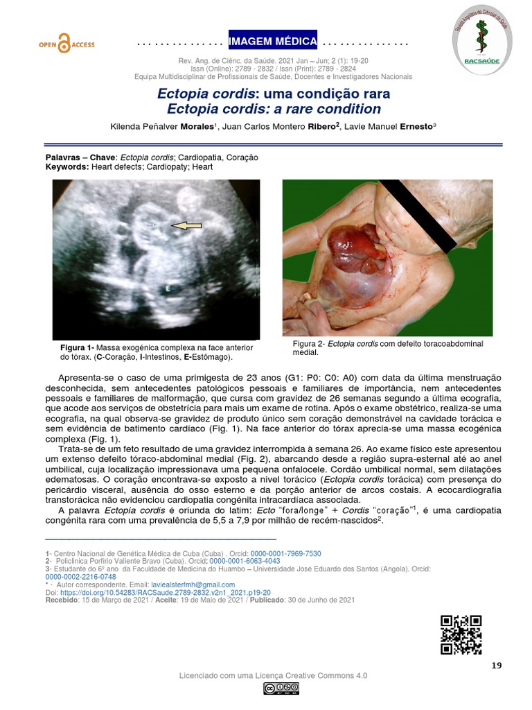 Ectopia Cordis: Condição Rara em Gestantes | PDF | Gravidez | Coração