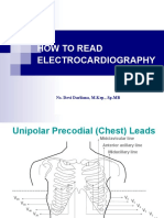 How To Read Electrocardiography: Ns. Devi Darliana, M.Kep., SP - MB