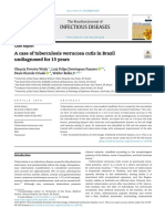 Infectious Diseases: A Case of Tuberculosis Verrucosa Cutis in Brazil Undiagnosed For 15 Years