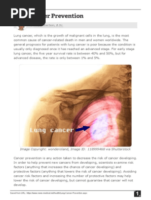 Lung Cancer Prevention Pdf Lung Cancer Cancer