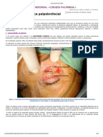 Anatomia Quirurgica Palpebrofacial