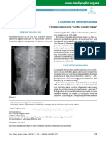 Colecistitis Enfisematosa: Presentación Del Caso