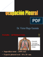 Derrame Pleural