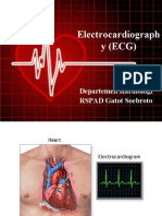 EKG Abnormal