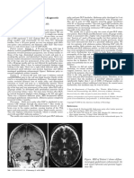 Clinical/Scientific Notes: The Risk of Abducens Palsy After Diagnostic Lumbar Puncture